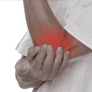 pressure injury 2