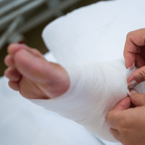 pressure injury